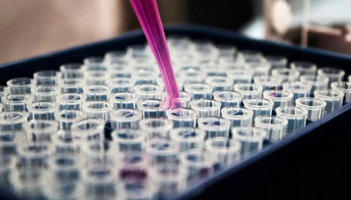  Pesquisas brasileiras avançam no diagnóstico de Alzheimer 